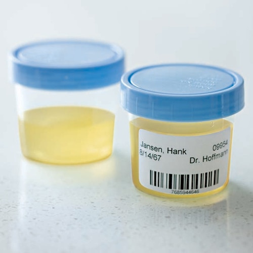 Dymo LabelWriter for printing Urine Sample labels